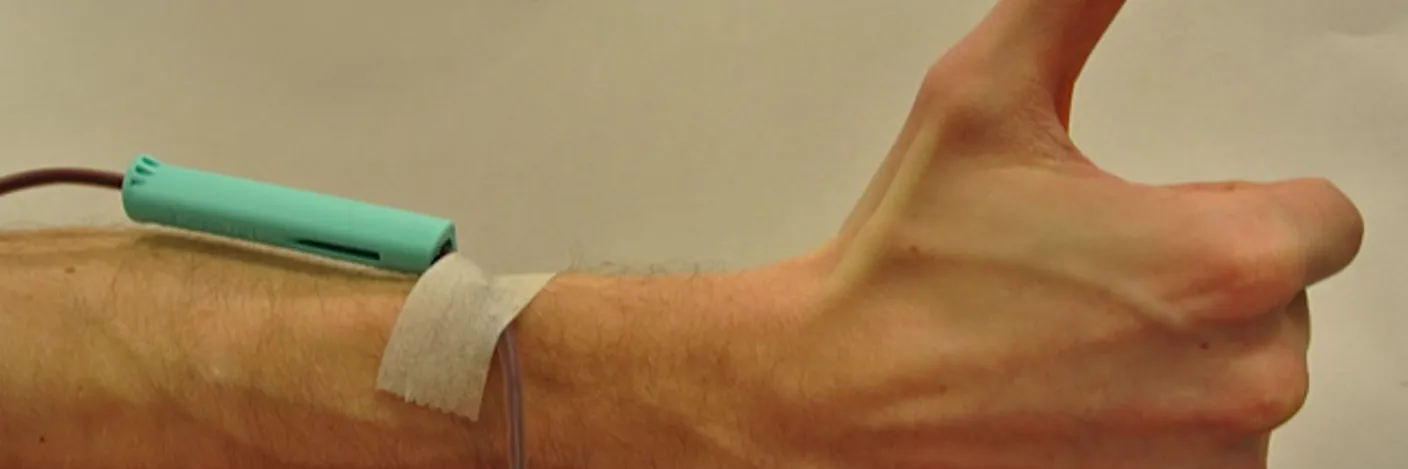 En persons hånd og underarm med et rør festet til den og tommelen opp