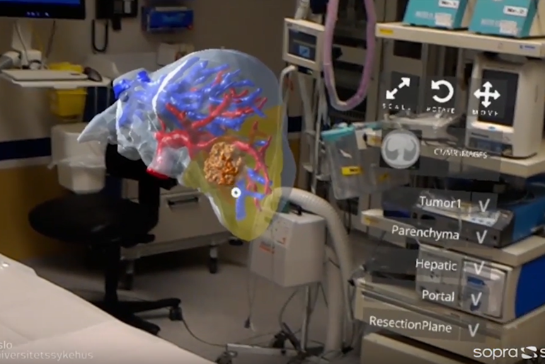 3D holografi