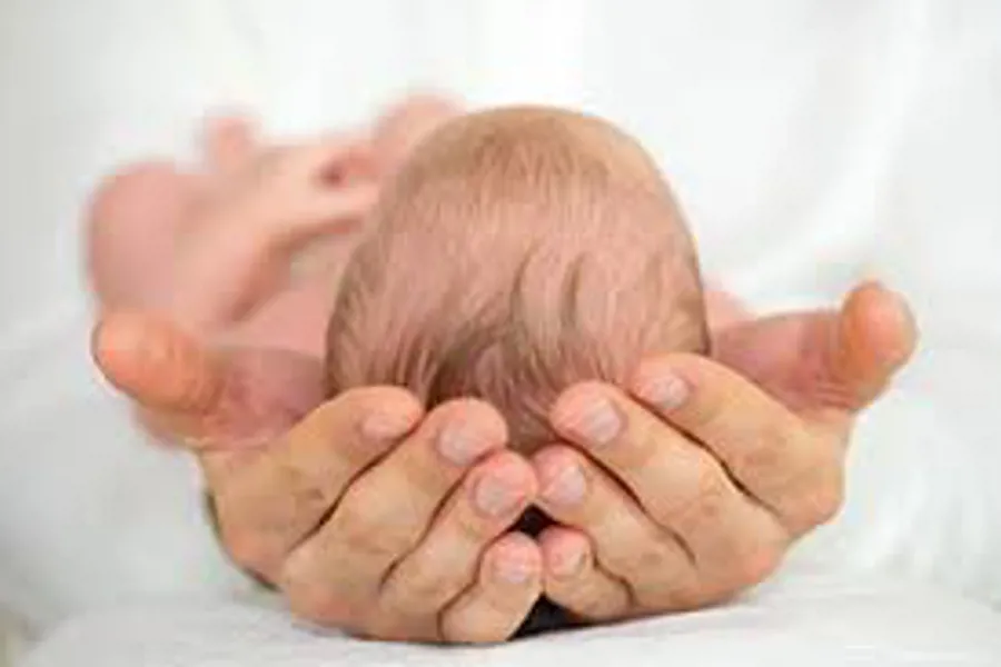 Bilde av oversiden av hodet til et spedbarn som blir holdt mellom to hender