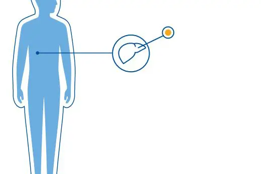 Diagnoseillustrasjon