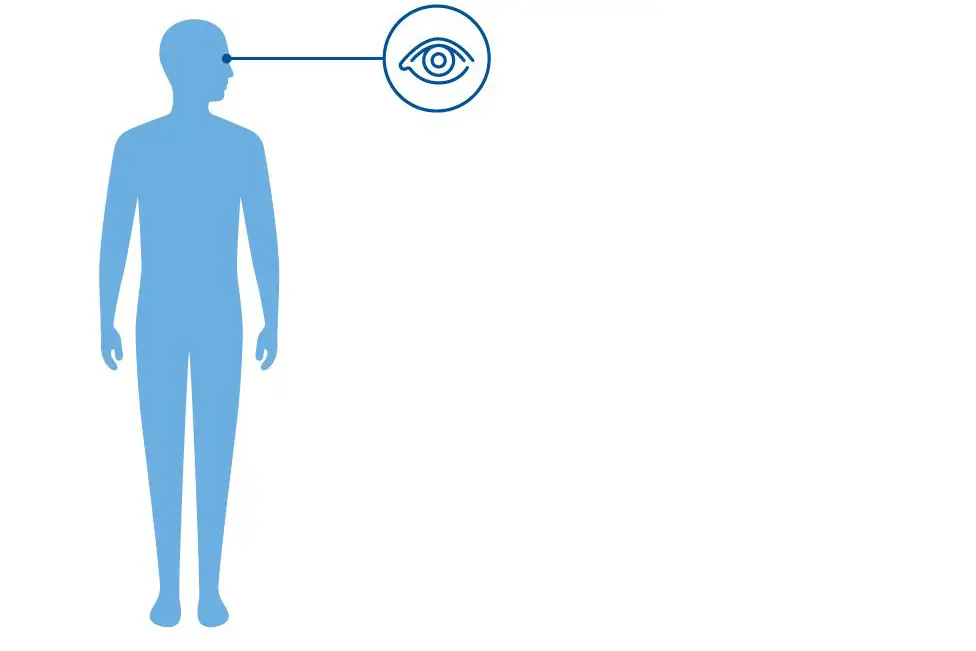 Illustrasjon av en blå menneskefikur med et utstrakt ikon av et øye, som viser at Bardet.Biedl syndrom påvirker øynene. 