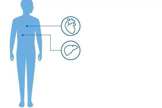Illustrasjon av en blå menneskekropp og to ikoner av et hjerte og en lever som viser at Alagilles syndrom påvirker disse organen