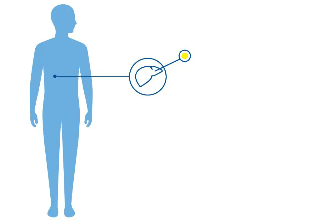 Diagnoseillustrasjon.