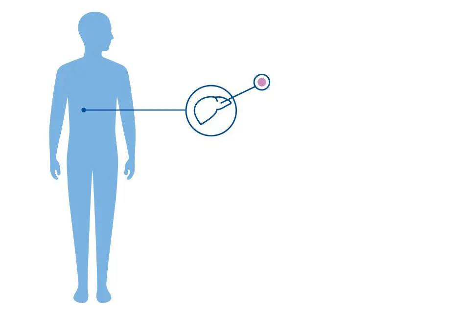 Diagnoseillustrasjon