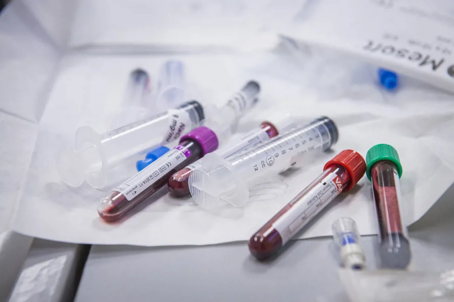 Bilde av blodprøver