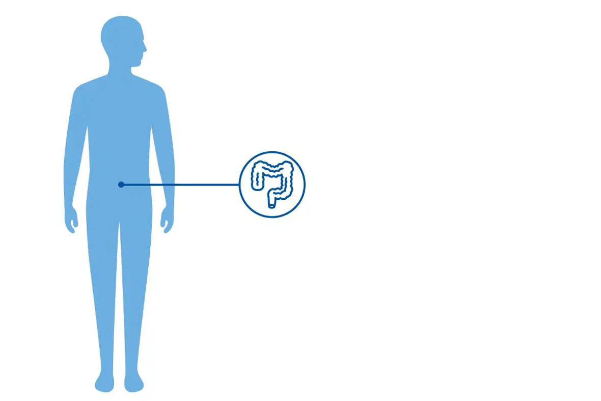 Illustrasjon av en blå menneskekropp og et ikon av tarmen som viser at ARM påvirker nedre del av tarmen