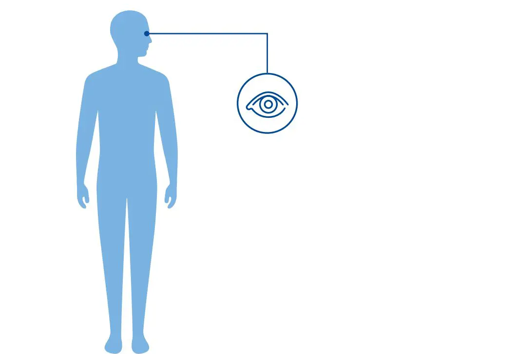 Illustrasjon av en blå menneskekropp og et ikon av ett øye som viser at Aniridi er en øyesykdom. 