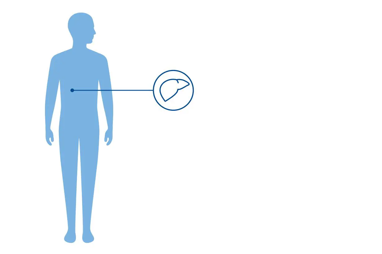 Illustrasjon av en blå menneskekropp og et ikon av en lever som viser at Aagenæs syndrom er en leversykdom.