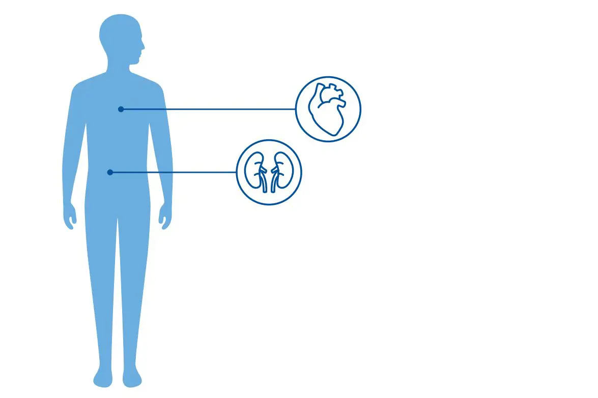 Illustrasjon av en blå menneskekropp med uthevet symbol av hjerte og  nyrer, so viser at Fabry påvirker disse organene. 
