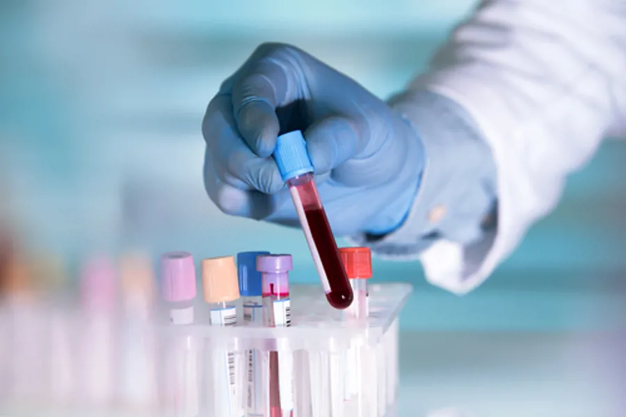 Hånd med blå hanske plasserer et reagensrør med blod i ned i en eske med andre blodprøver
