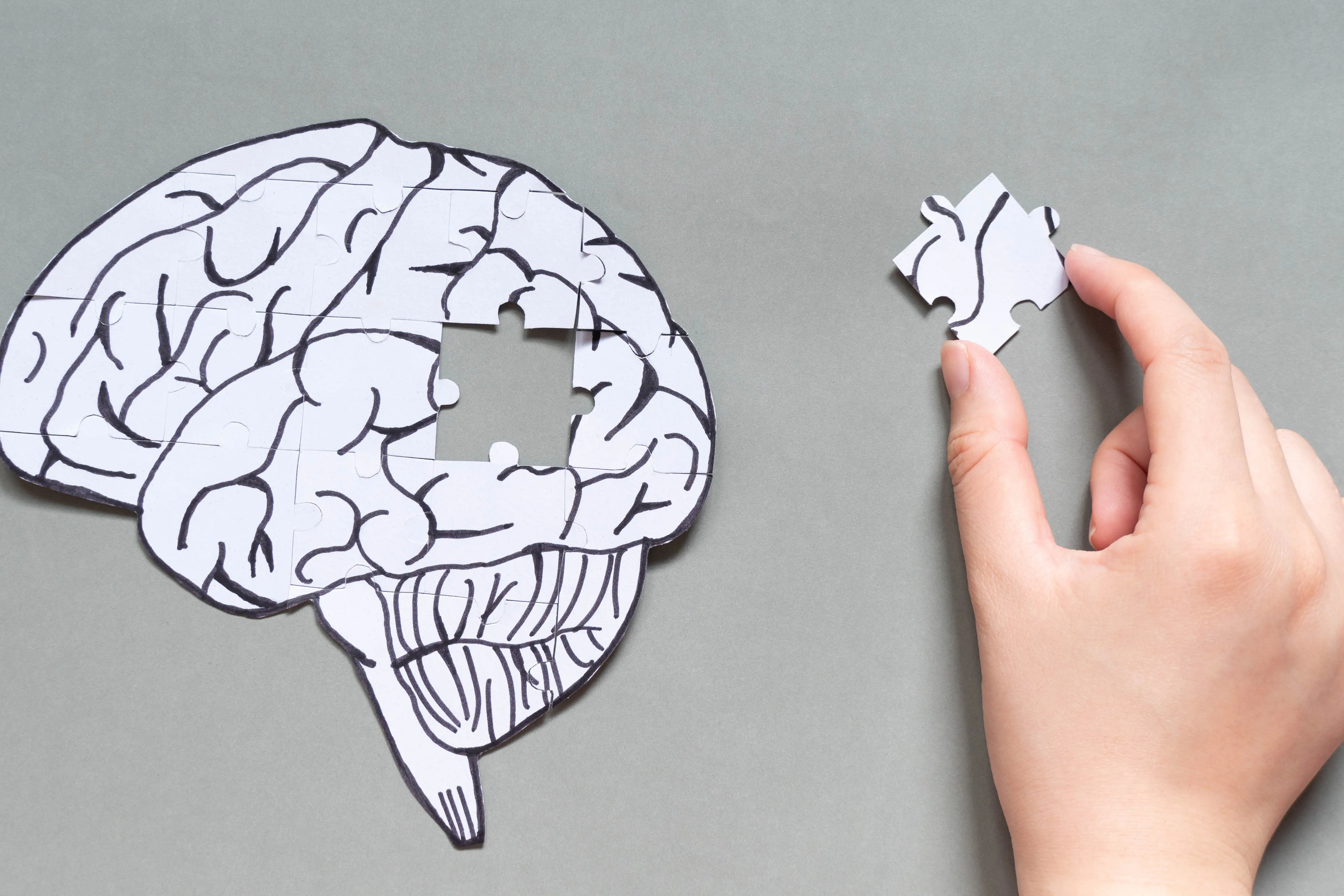 Illustrerende bilde av hjerne