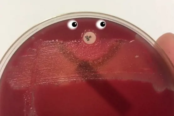 Bilde av bakterie