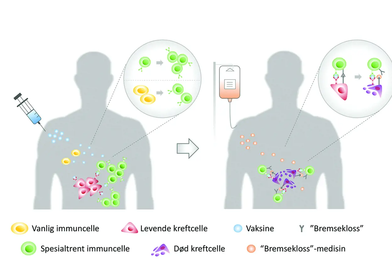 Illustrasjon som viser hvordan kroppen kan lage flere spesialtrente immunceller som kan drepe kreftcellene.