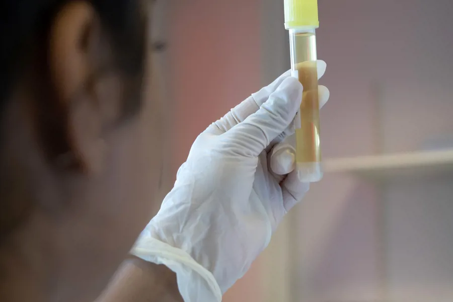 En kvinne i laboratoriefrakk som holder en sprøyte