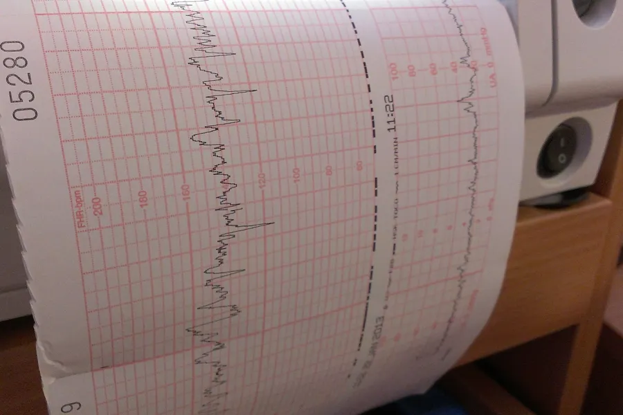 EKG measure, illustration photo