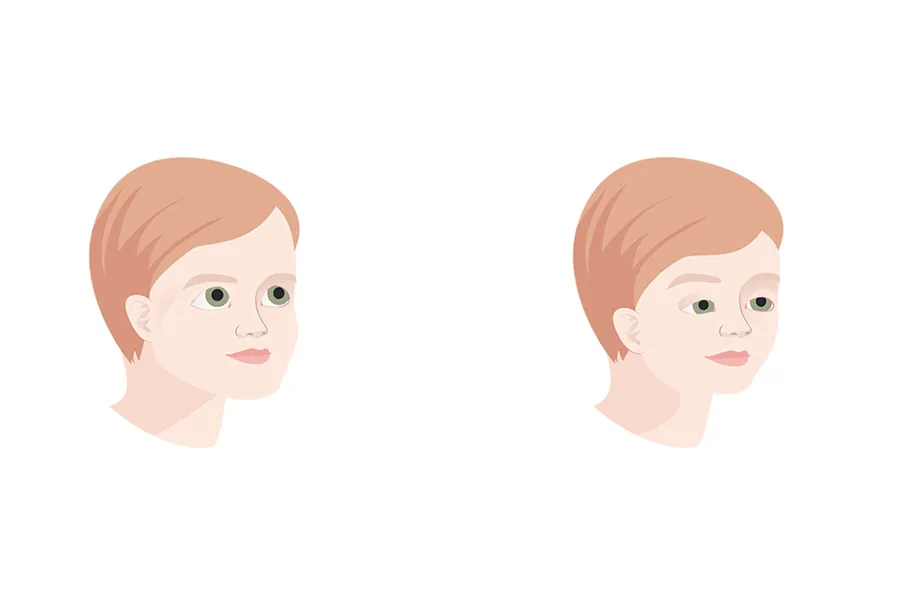 Tegning av to ansikter med ulike øyne og panne.