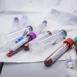 Illustrasjonsfoto av blodprøver