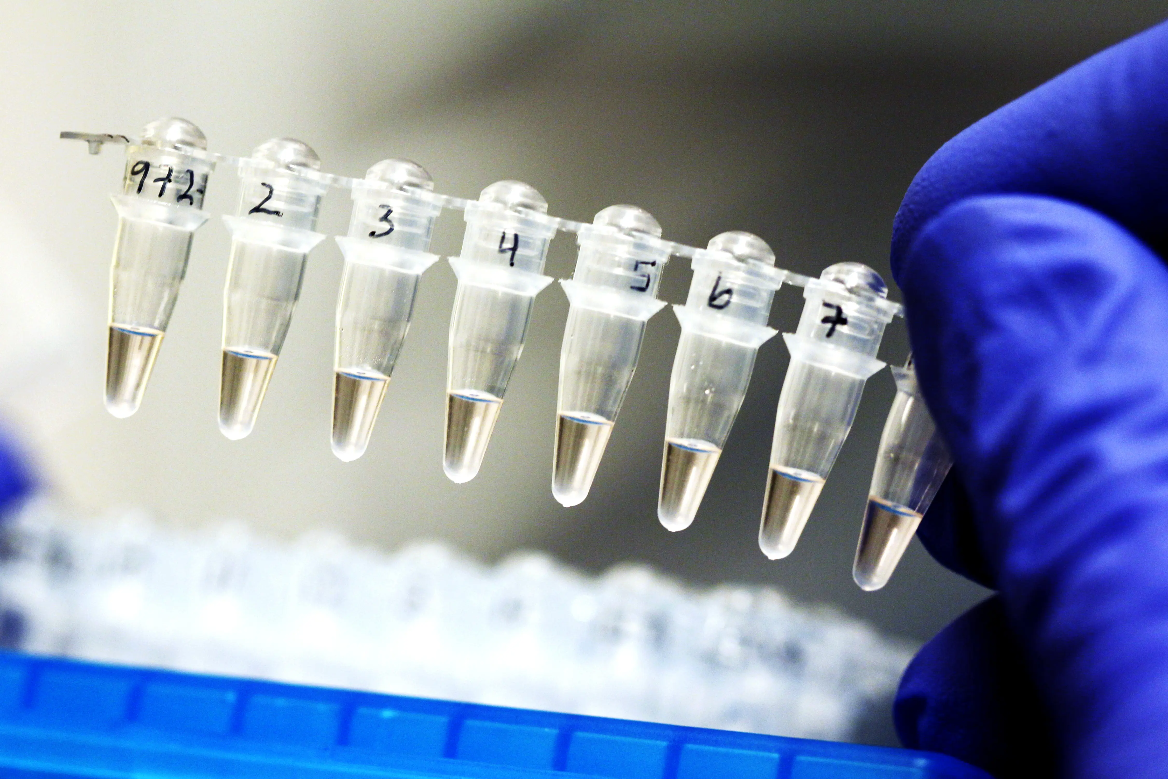 Bilde av analyse, en rad med pipetter