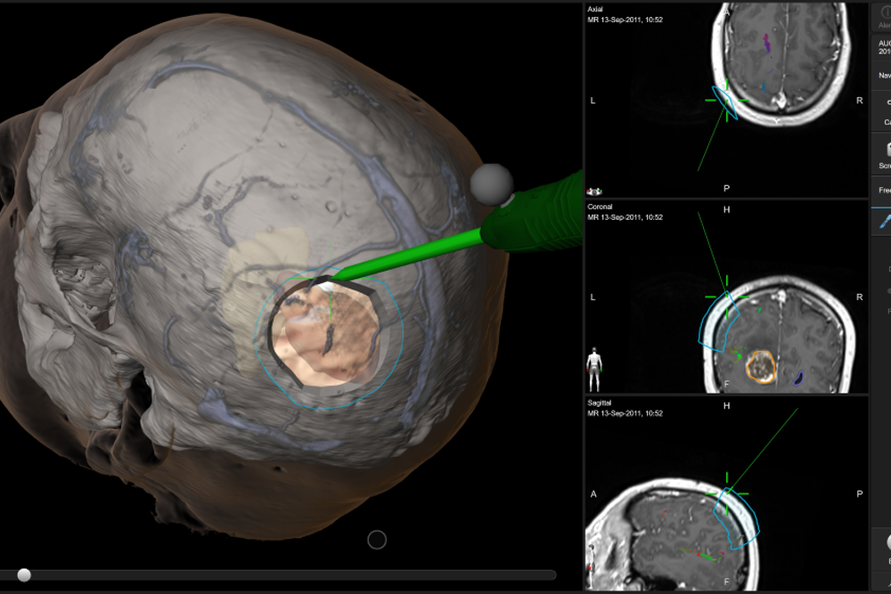 Bilde fra Brainlab